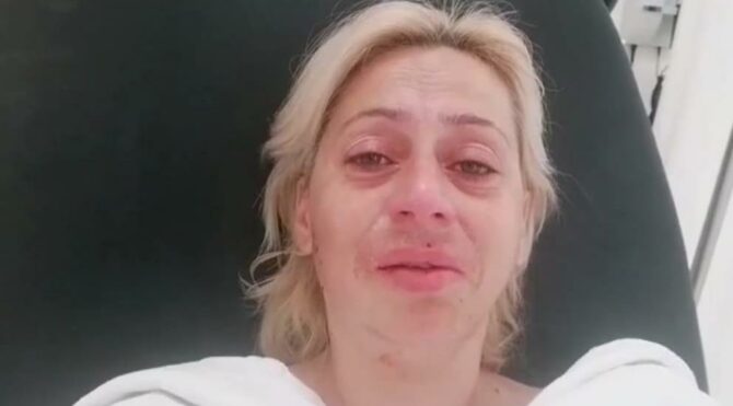 Sokak köpeği besleyen  kadının çenesini kırdılar