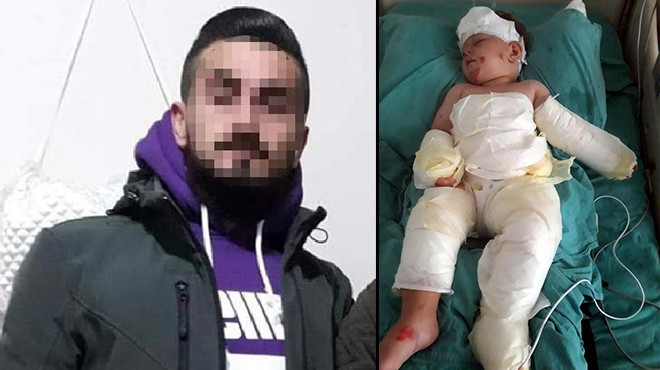Eşini ve oğlunu, üzerlerine kolonya dökerek ateşe verdi !