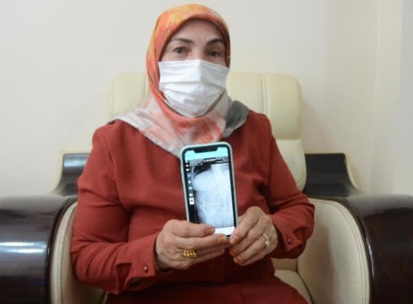 Zayıflamak için girdiği ameliyatta  karnında makas unutuldu